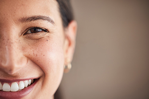 OptiPlus RF Dry Eye Treatment in Redding